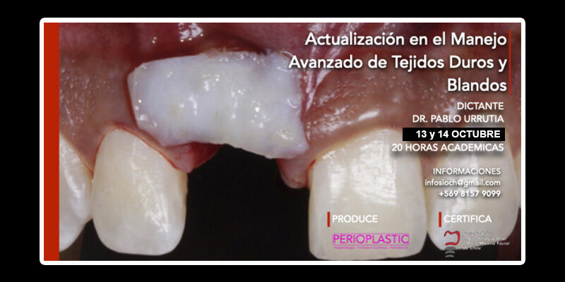 SIOCH-manejo-tejidos-avanzado-(5)–