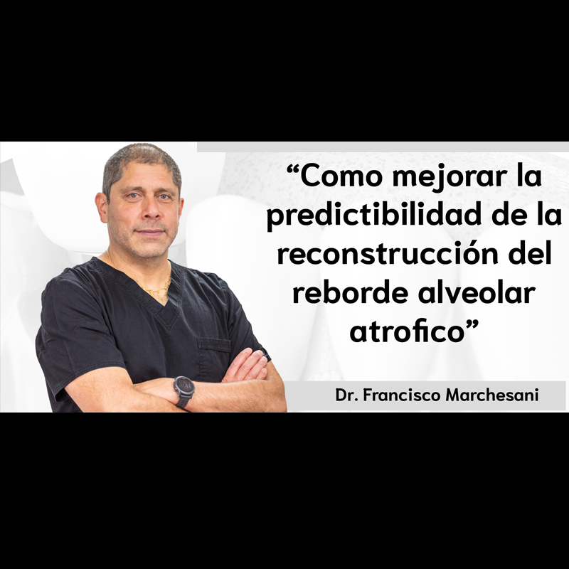 SIOCH-03-JUNIO