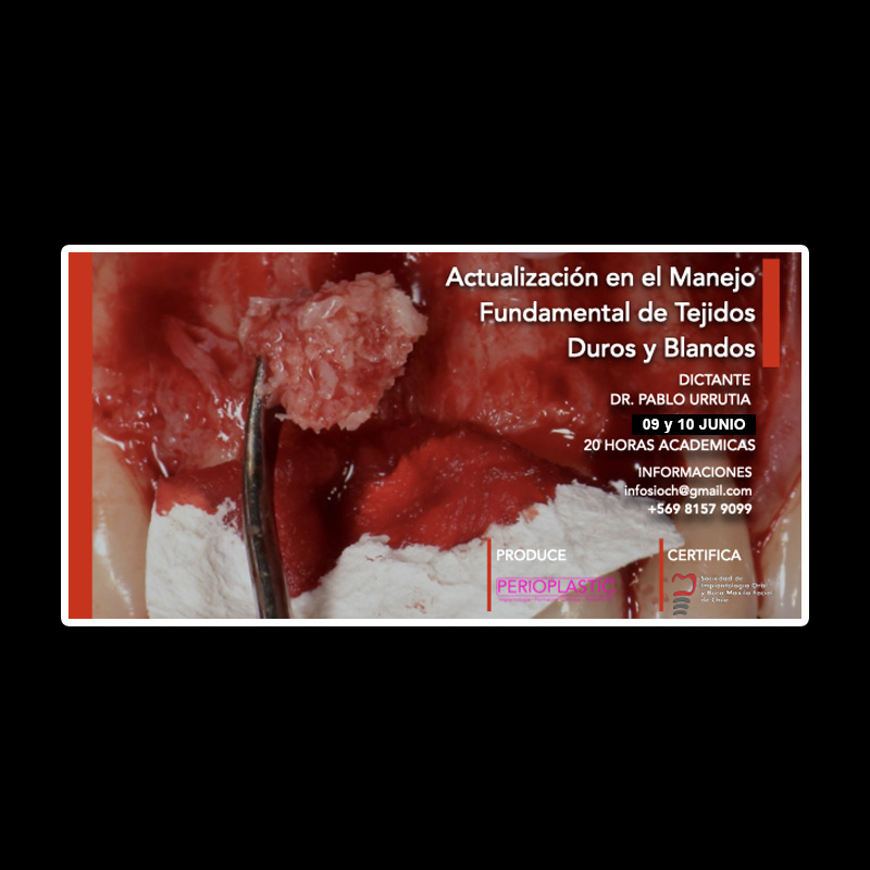 SIOCH-manejo-tejidos-(5)