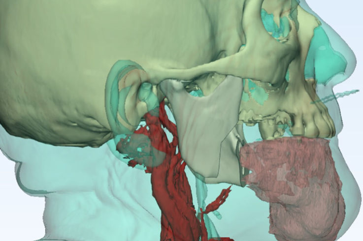 Jornada-Manejo-Avanzado-Tumores-Region-Maxilofacial