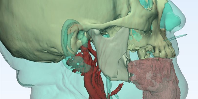 Jornada-Manejo-Avanzado-Tumores-Region-Maxilofacial