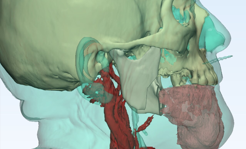 Jornada-Manejo-Avanzado-Tumores-Region-Maxilofacial