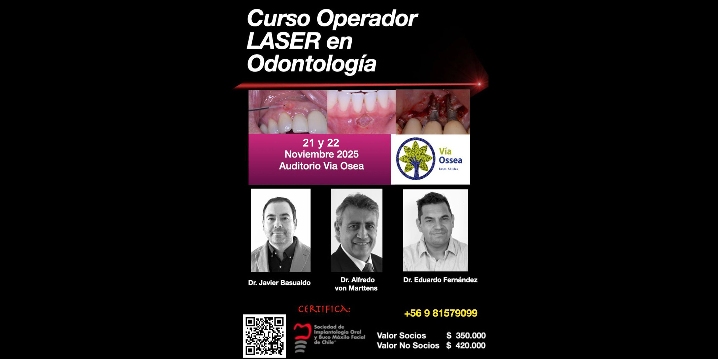 –curso-operador-laser–