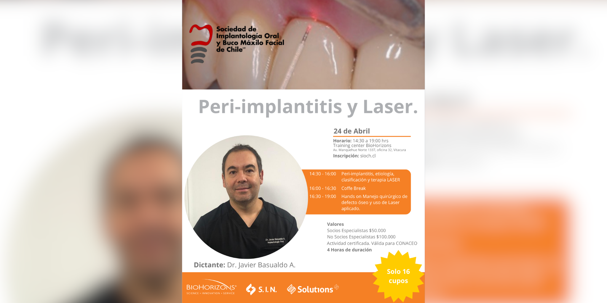 SIOCH-Periimplantitis-